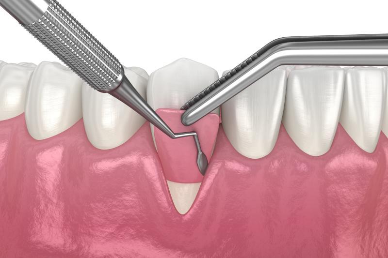 Periodontologia